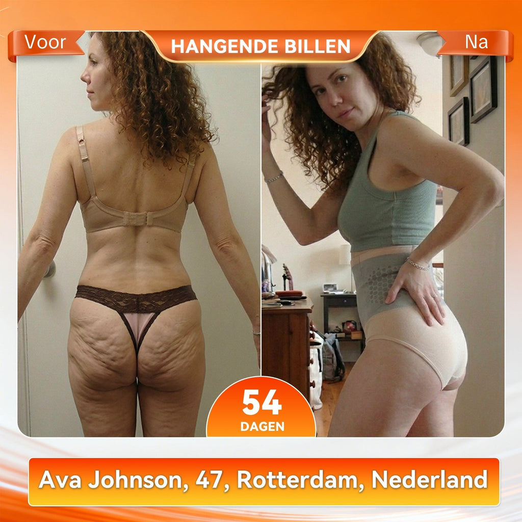 ShapeFit Afval Shorts • Zichtbaar resultaat